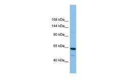 Glutamate Receptor 6 Antibody, Novus Biologicals 100 &mu;L | Buy Online | Novus Biologicals | Fisher Scientific